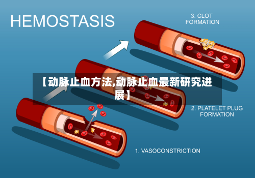 【动脉止血方法,动脉止血最新研究进展】-第2张图片